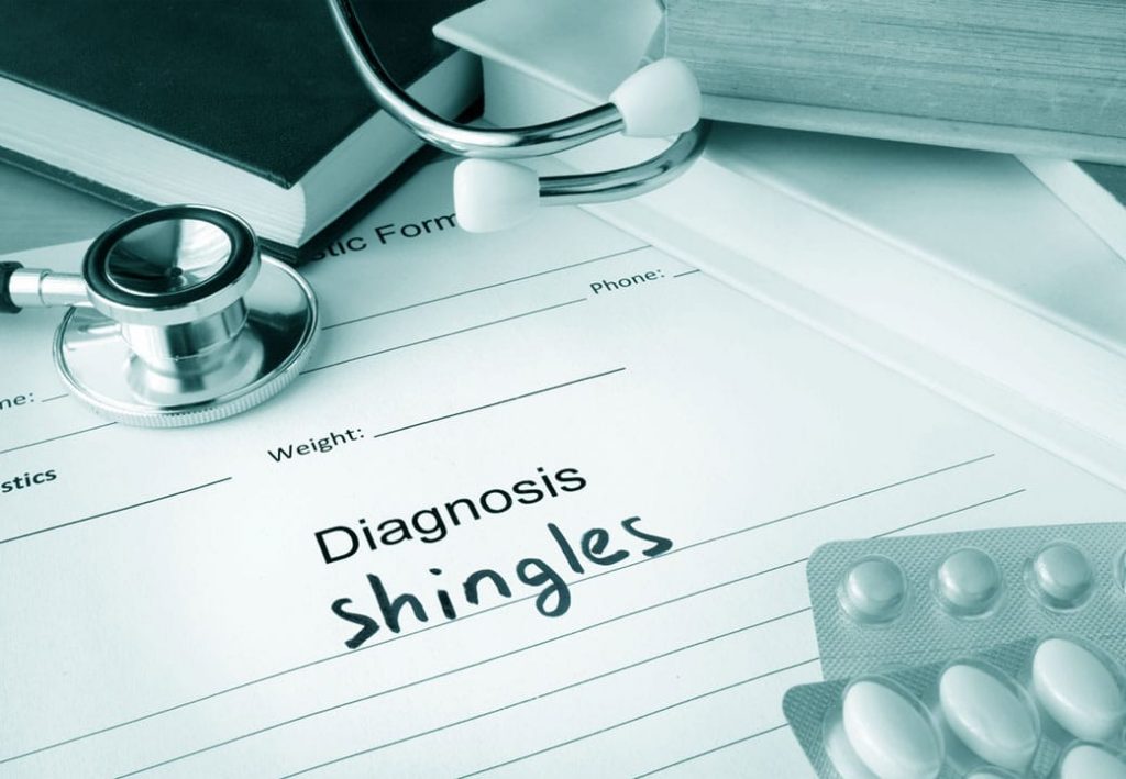 All About Shingles