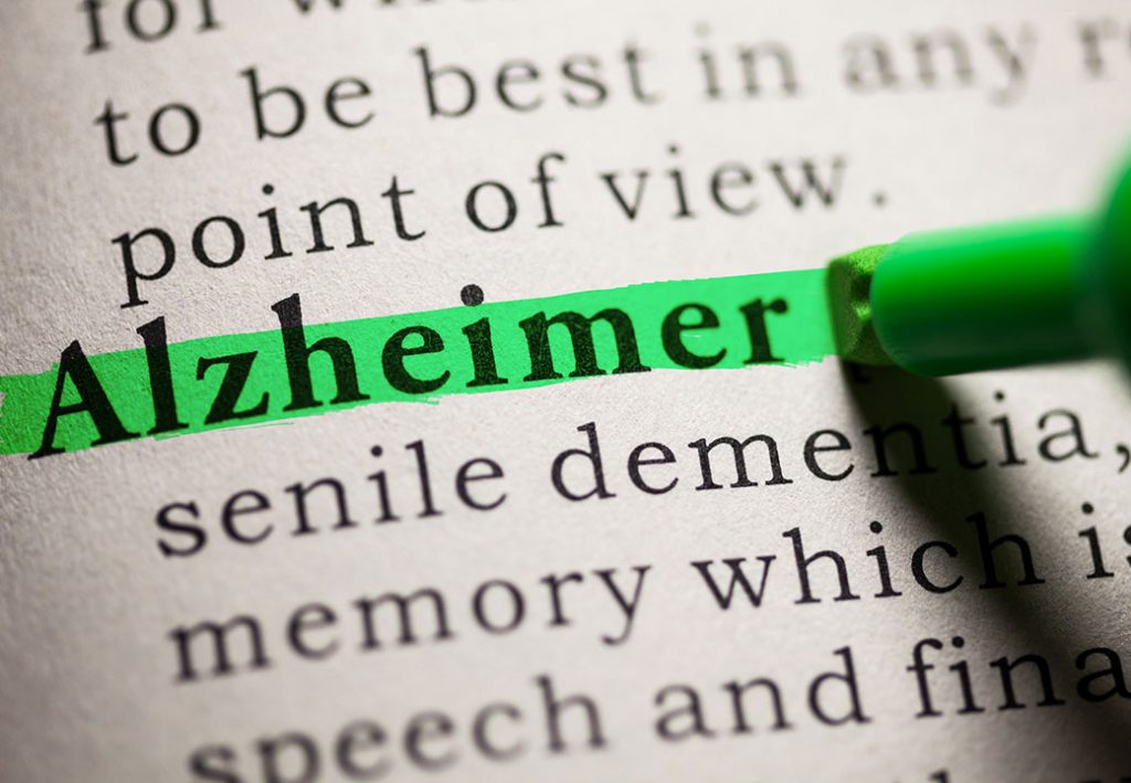 Forget me not: 5 steps to reduce your risk of Alzheimer’s